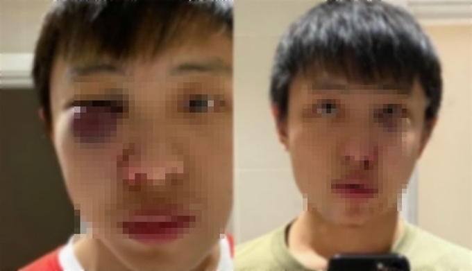 이미지에 대체텍스트 속성이 없습니다; 파일명은 3lfy08ra1lu76smwp3v2.jpg 입니다.