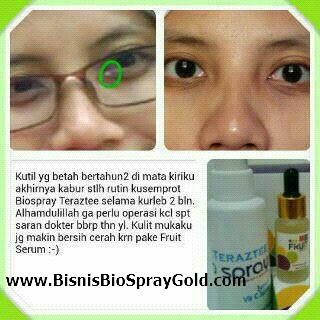 Testimoni MSI Bio Spray - Multy Spray Testimoni MSI Bio Spray, Testimoni MSI Multy Spray