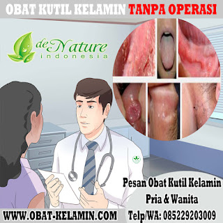 Obat Kutil Kelamin Obat Kutil Kelamin