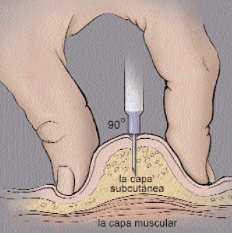 inyecciones subcutaneas en el brazo