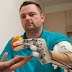 First bionic hand with real feeling