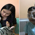 Beware Parents: If You Don't Want Your Children To Go Blind Like This 2-Year-Old, Limit Their Use Of Smartphones
