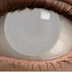DANGER! THIS ACTIVITY LEAVES MORE THAN 30 PEOPLE BLIND EVERY DAY!