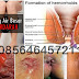 Jual Obat Wasir Obat Ambeien Obat Anus Bengkak thumbnail
