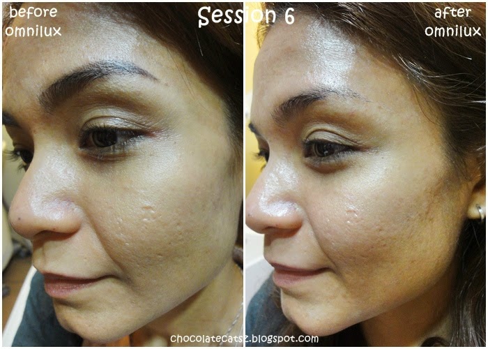 Chocolate Cats Review Omnilux LED Therapy! Great Complexion Made Easy!