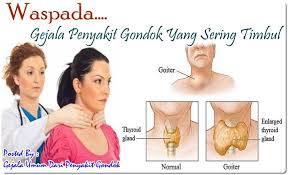 Image BERAPA HARGA OBAT PENYAKIT GONDOK YANG TERSEDIA DIAPOTIK SEKITAR
