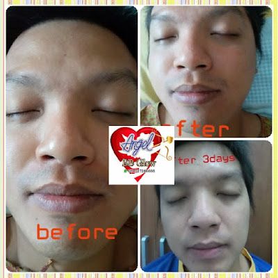 Cantik Dengan Angel BB Glow Buat Wajahmu Biar Menarik
