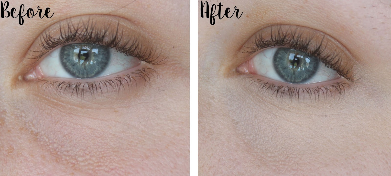 dermablend color corrector