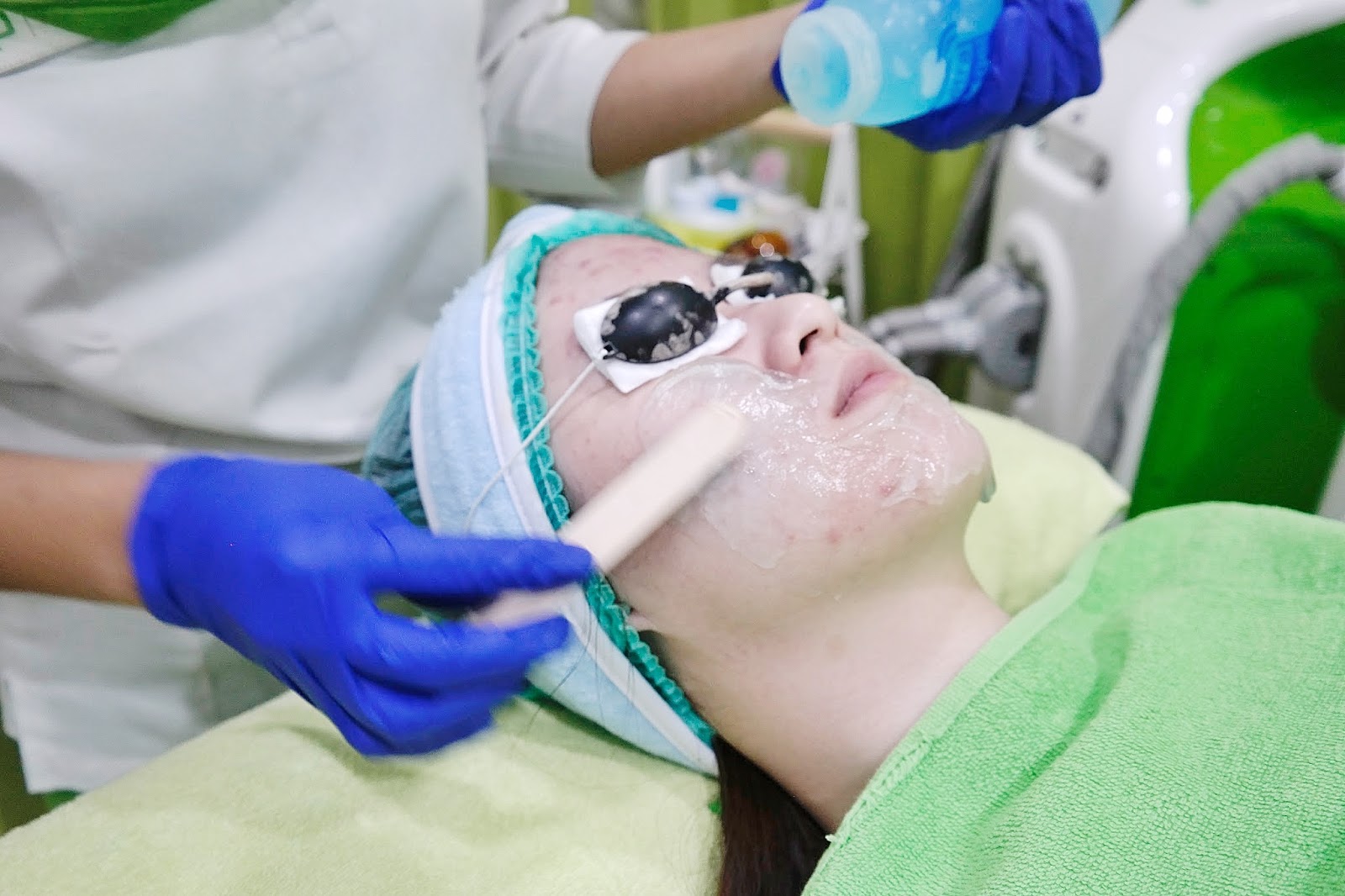 [REVIEW] ZAP Photo Facial Experience Erisca's Beauty Blog