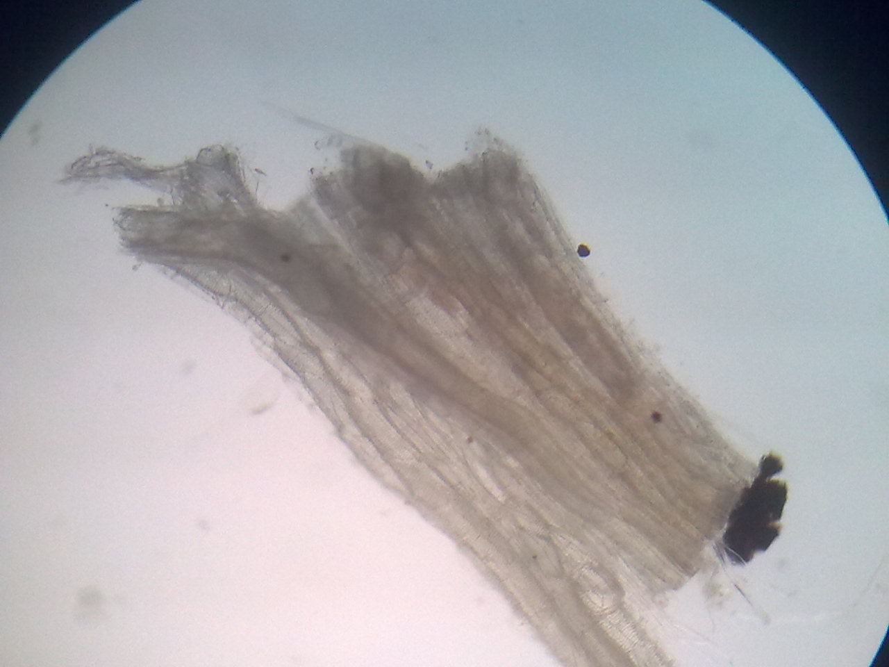 aline Monserrat Escamilla Peña: Técnicas macroscópicas ...