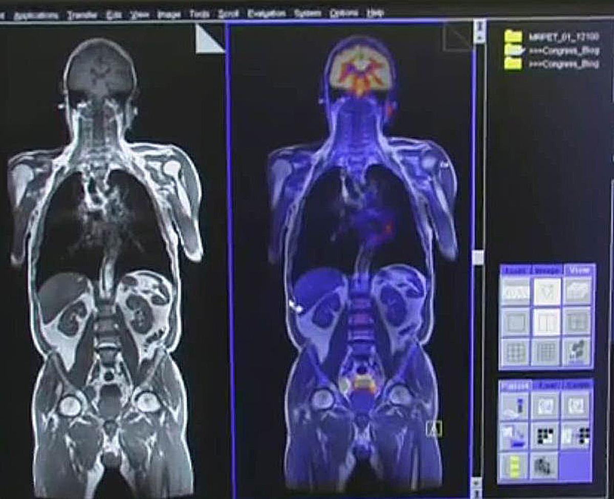 MRI and Medical Imaging: MR-PET: Μια νέα προσέγγιση στον τομέα της ...