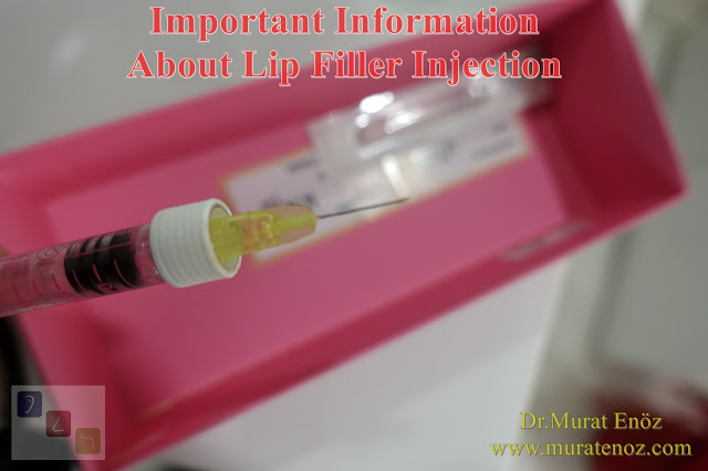 Risks of lip filler - Side effects or risks of lip filler injection - Best filler material - Risks of silicon-containing fillers - Lip augmentation with filler in Istanbul - Shaping lips with fillers - Lip enhancement with fillers in İstanbul, Turkey - Non-surgical lip augmentation - Lip augmentation and enhancement with filler - Lip filler - Lip augmentation in Istanbul - Lip augmentation (hyaluronic acid fillers) in Istanbul