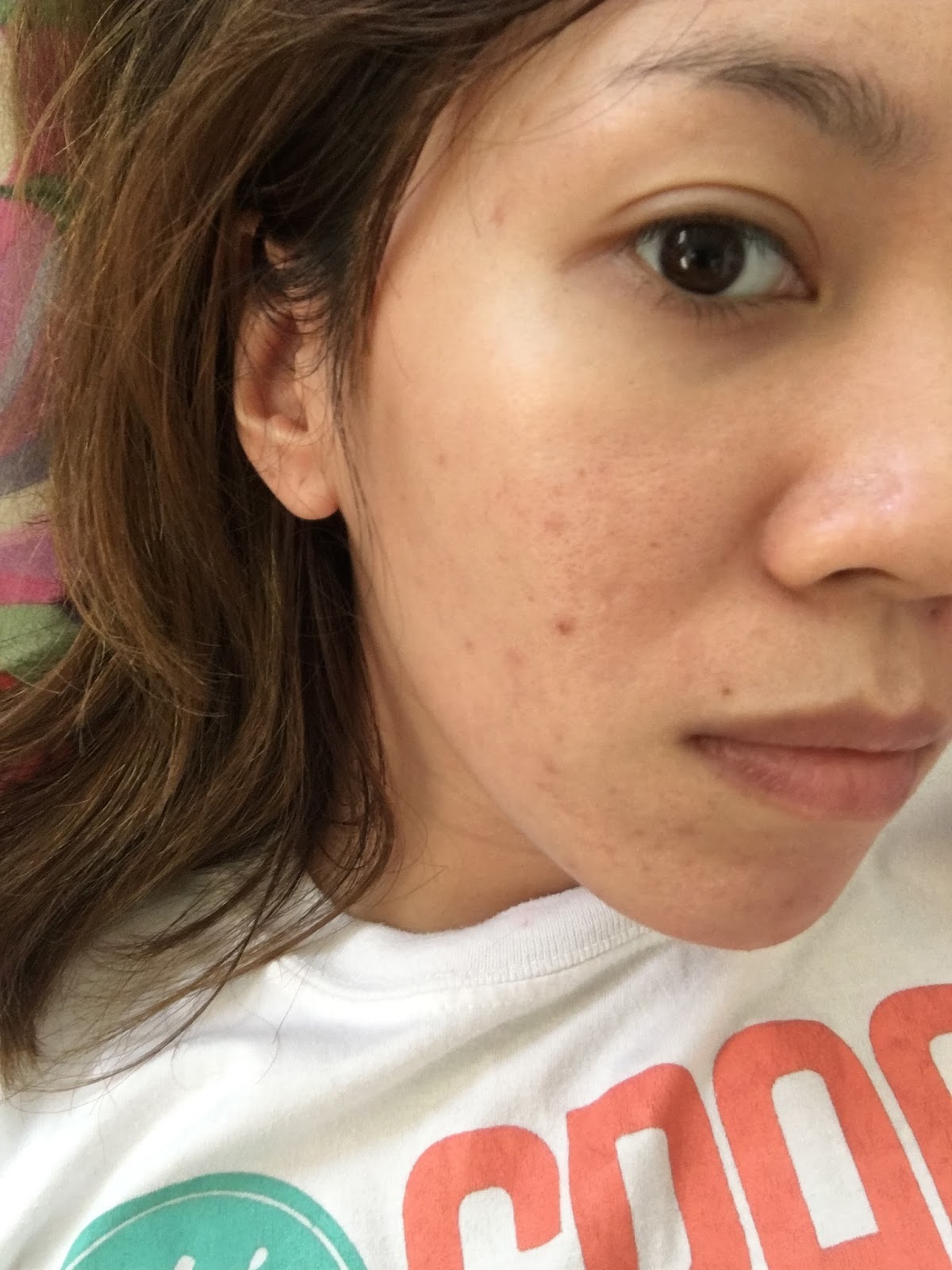 revlite skin 101 price