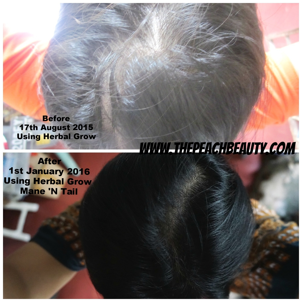 Peach Beauty By Maria Clara Fashion Lifestyle Blogger Before And After