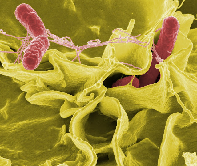 SALMONELLA Morphology, Laboratory diagnosis, Cultural characteristics Gyan Park