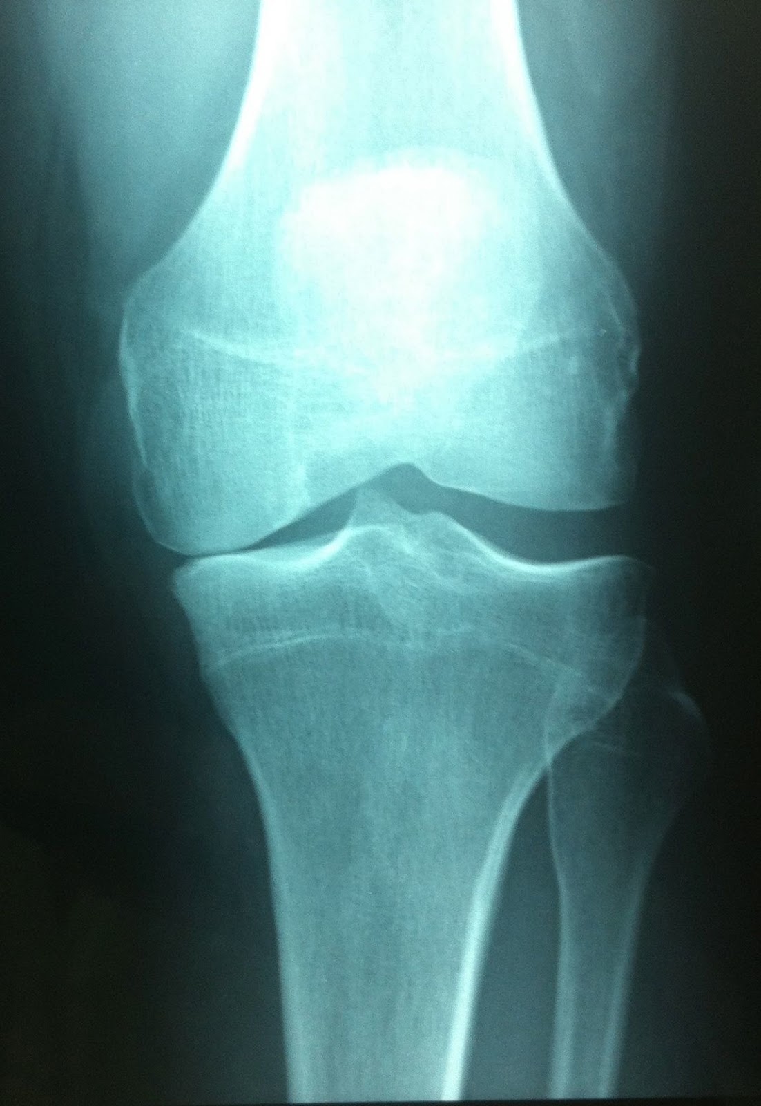 Institut du Genou Arthrosport Dr Michel