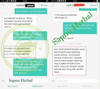 Cara Menghilangkan Benjolan Lunak Di Lubang Hidung Cara Menghilangkan Benjolan Lunak Di Lubang Hidung