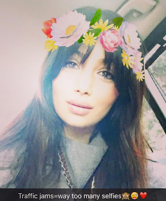 Ayesha Takia lip surgery latest photo