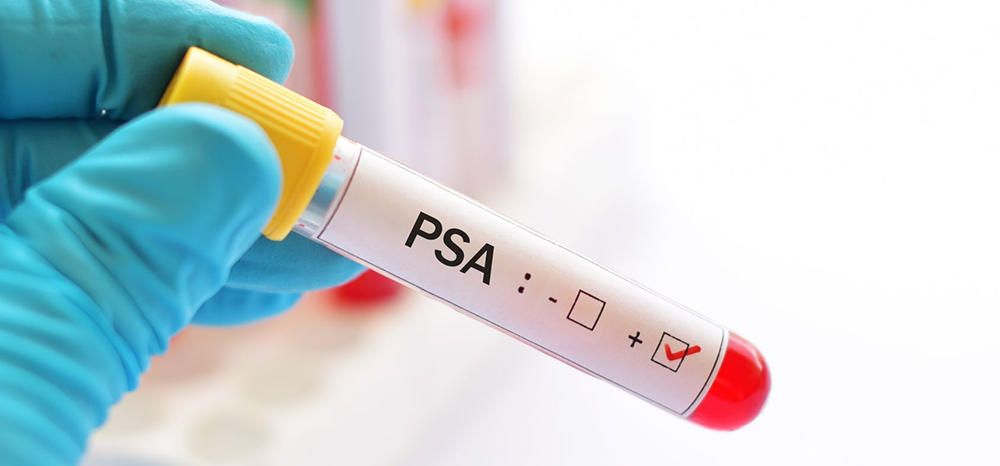 exame psa prostata preparo