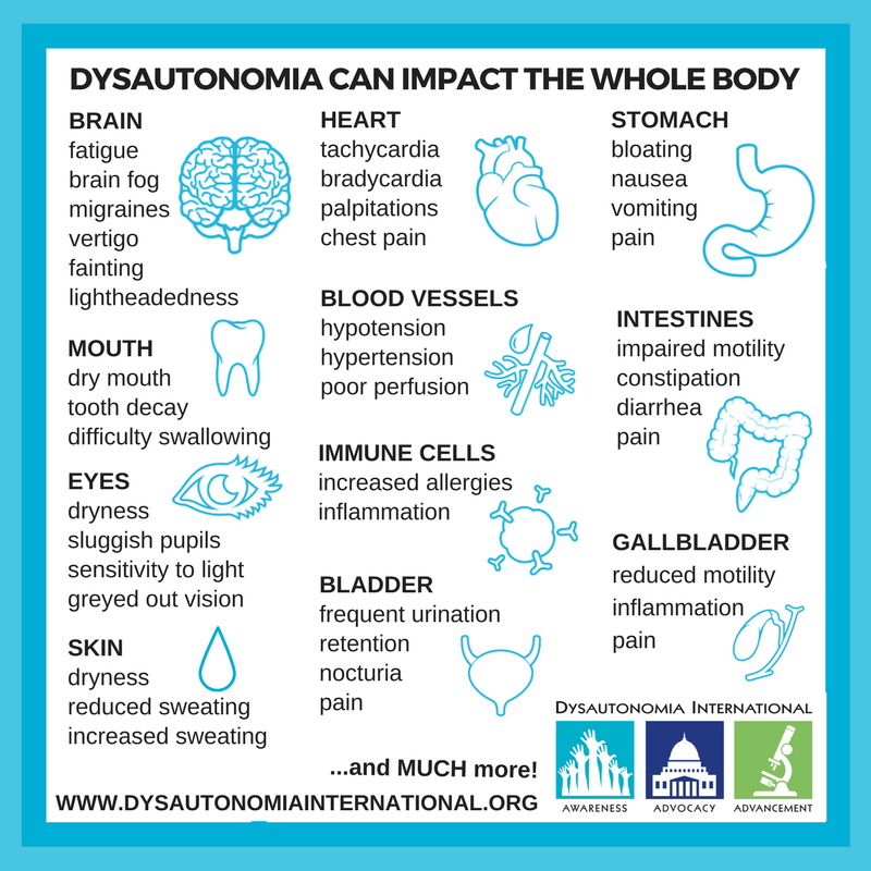 Syndrome causes pots POTS: Causes,