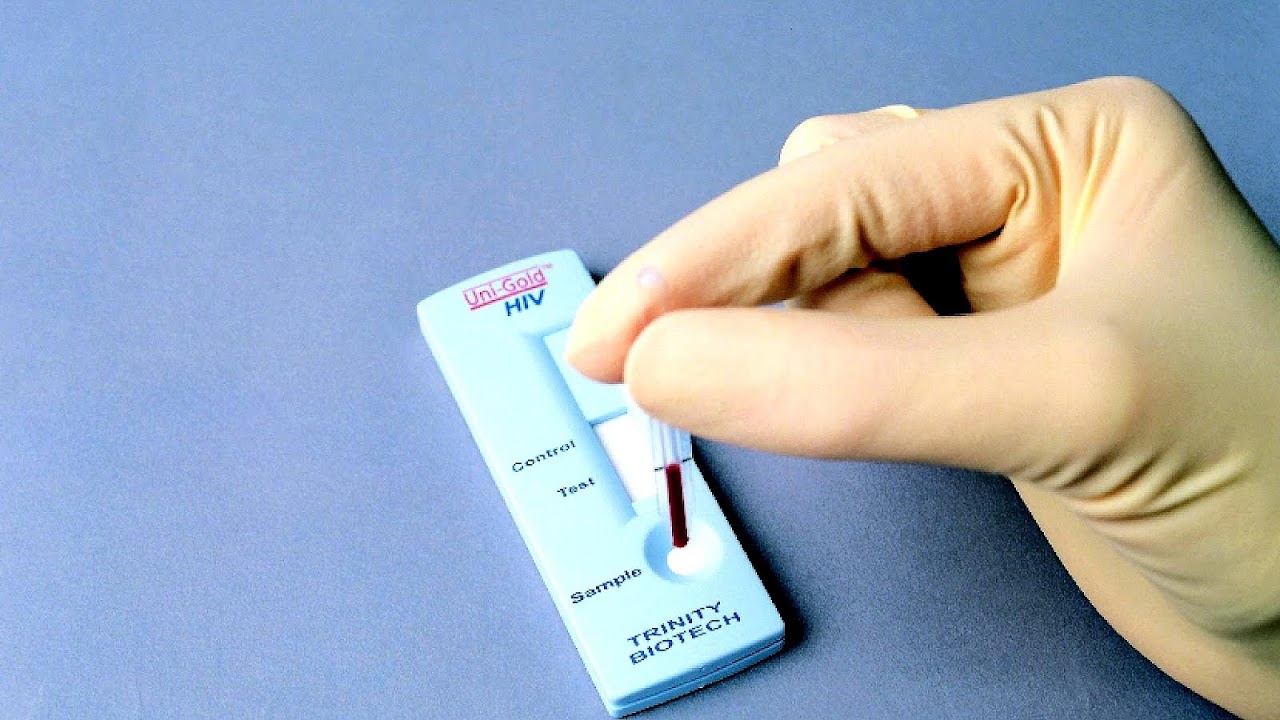 Uni Gold Hiv Test Gold Choices