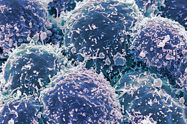 Why your immune system is key in the fight against cancer