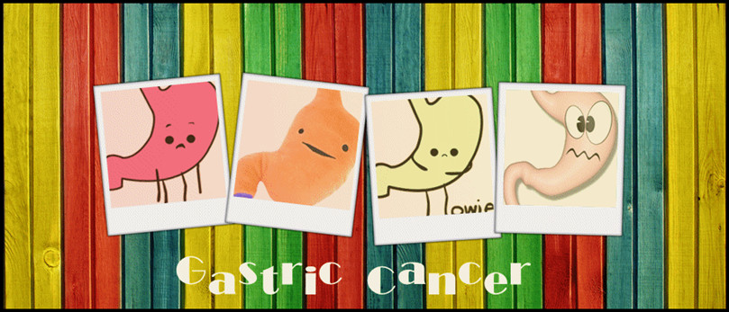 ••Gastric Cancer