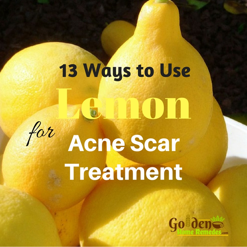 Best Natural Ingredients To Get Rid Of Acne Scars Best Natural Ingredients To Get Rid Of Acne Scars