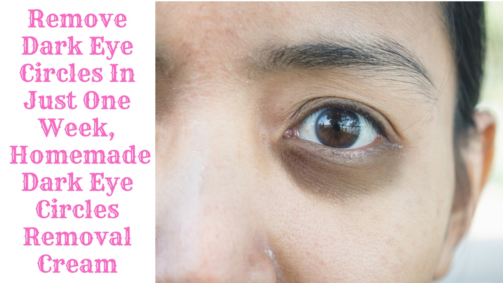 Remove Dark Eye Circles In Just One Week, Homemade Dark Eye Circles