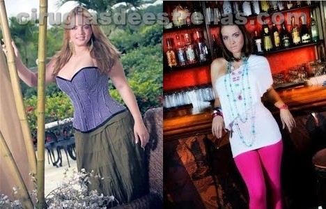 Rafa balderrama antes y despues de adelgazar