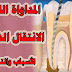 مشاكل علاج عصب الأسنان والتدبير: انتقال الذروة أثناء التحضير مشاكل علاج عصب الأسنان والتدبير: انتقال الذروة أثناء التحضير