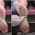 Say Goodbye to Troublesome Foot and Heel Pain