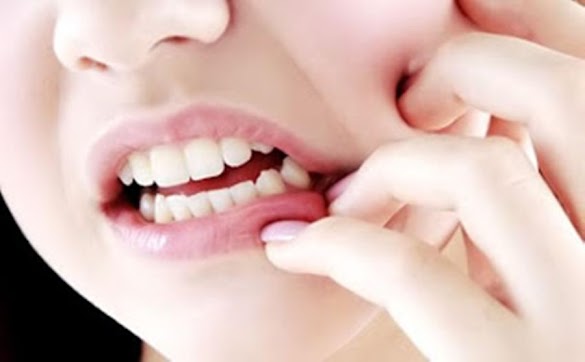 Bahan Alami Menyembuh Sakit Gigi, Dijamin Paling Mujarab