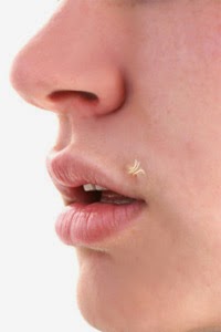 what are the causes of filiform warts