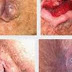 Salep dan Obat Wasir Ardium Ampuh thumbnail