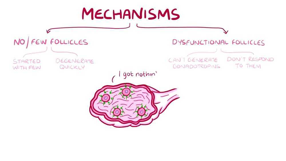 Premature Ovarian Failure premature-ovarian-failure
