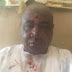 I've Learnt My Lessons - Blood-soaked Voter Who Survived An Attack In Kano