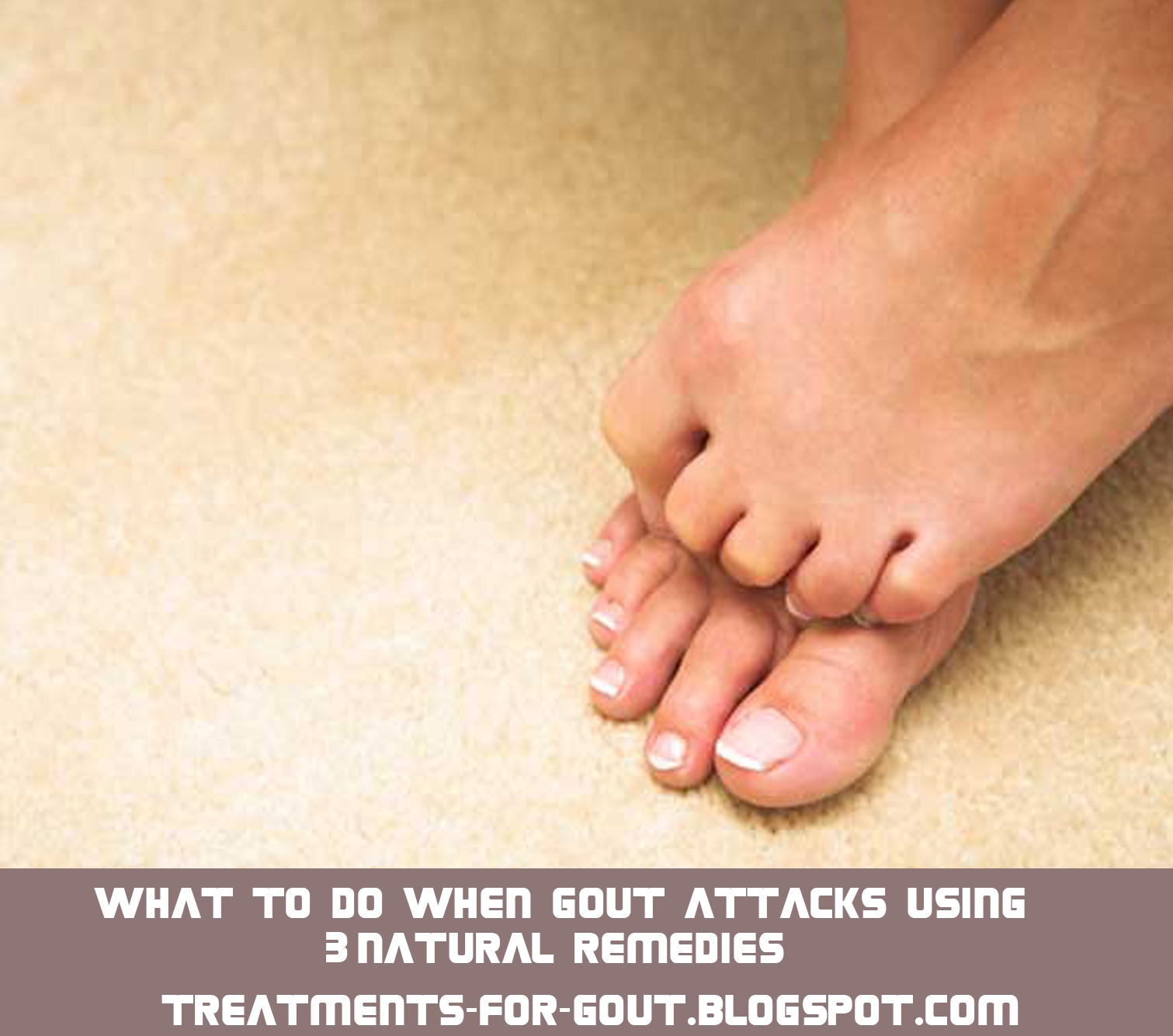 Gout Pictures: Causes, Symptoms, and Treatments - WebMD