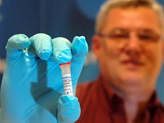 Controlan el virus del SIDA