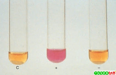 [Microbiology] Atlas of Mycobacterium tuberculosis and Other ...