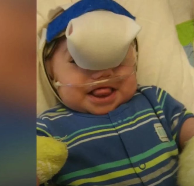 Doctors remove this from this baby's face