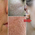 Easy and Affordable Way To Remove Pores On Your Face At Home