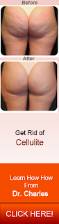 Cellulite Factor Solution