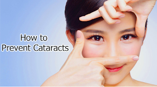 How to Prevent Cataracts