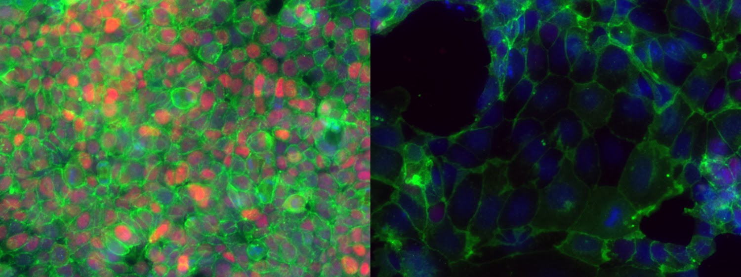 CellNEWS Why Stem Cells Need to Stick With Their Friends