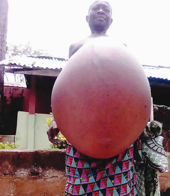 justice nzondu nigerian man with accumulated belly fat