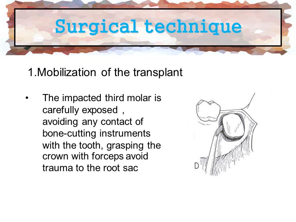 Dentistry: Tooth Transplantation