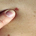 These Are The 10 Cancer Symptoms That People Ignore!