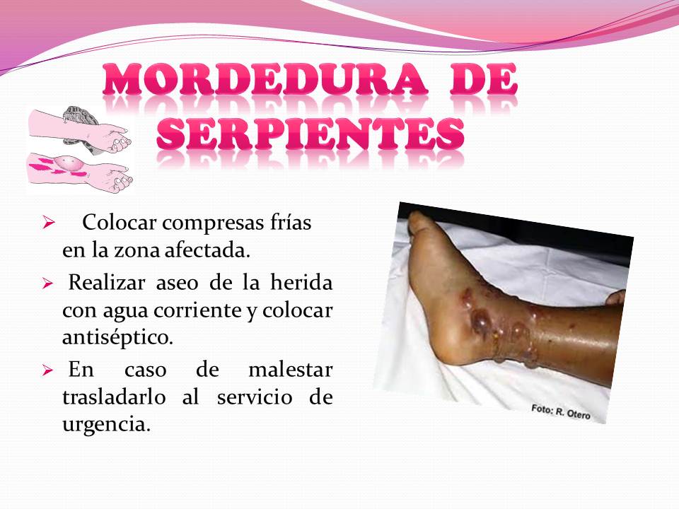 Primeros Auxilios Mordedura De Serpiente
