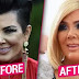 See Kris Jenner’s new face after invasive plastic surgery (Photos)